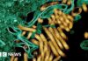 New outbreak of Ebola kills 65 in eastern DR Congo