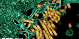 New outbreak of Ebola kills 65 in eastern DR Congo