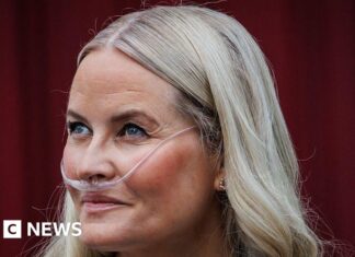 Norway's crown princess undergoes successful lung transplant, palace says